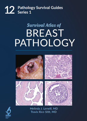 Survival Guide to Thoracic Pathology【新品】 Survival Guides | Innovative Science Press | Pathologist